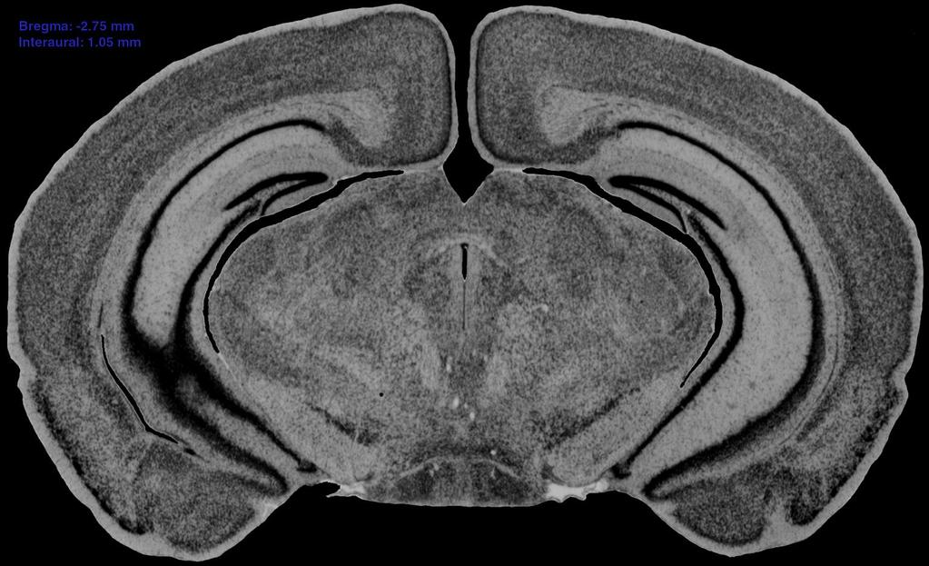 primary visual cortex (V1) dorsal