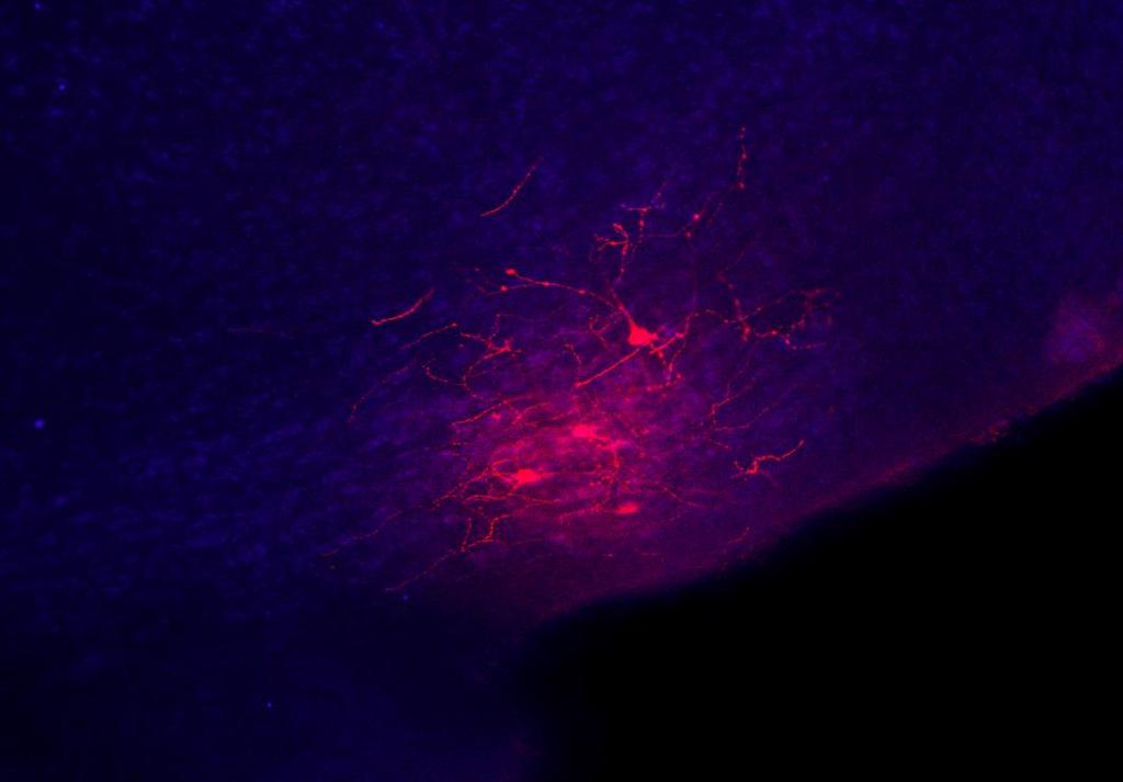 VIP neurons receive input from