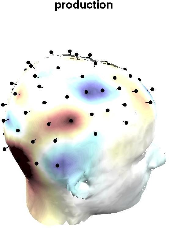 The data reported here support the idea that the imaginal module is associated with parietal theta oscillations, but do not support the mappings for visual and retrieval modules.