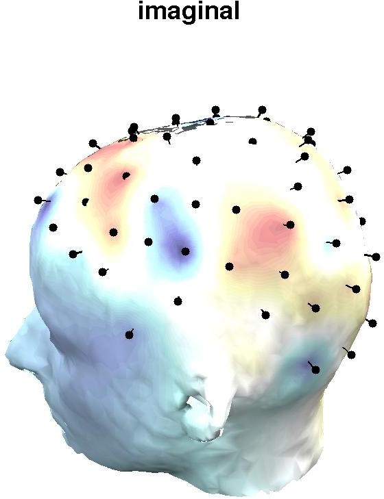 Interestingly, this mapping of the retrieval module is fairly consistent with fmri-based localization.