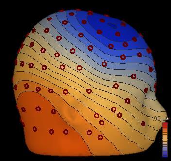 Forward and inverse problem in EEG Forward problem/solution Based on the active cortical areas,