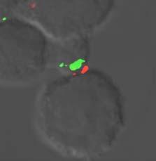 Cells were stained with antibodies against talin (goat anti-talin