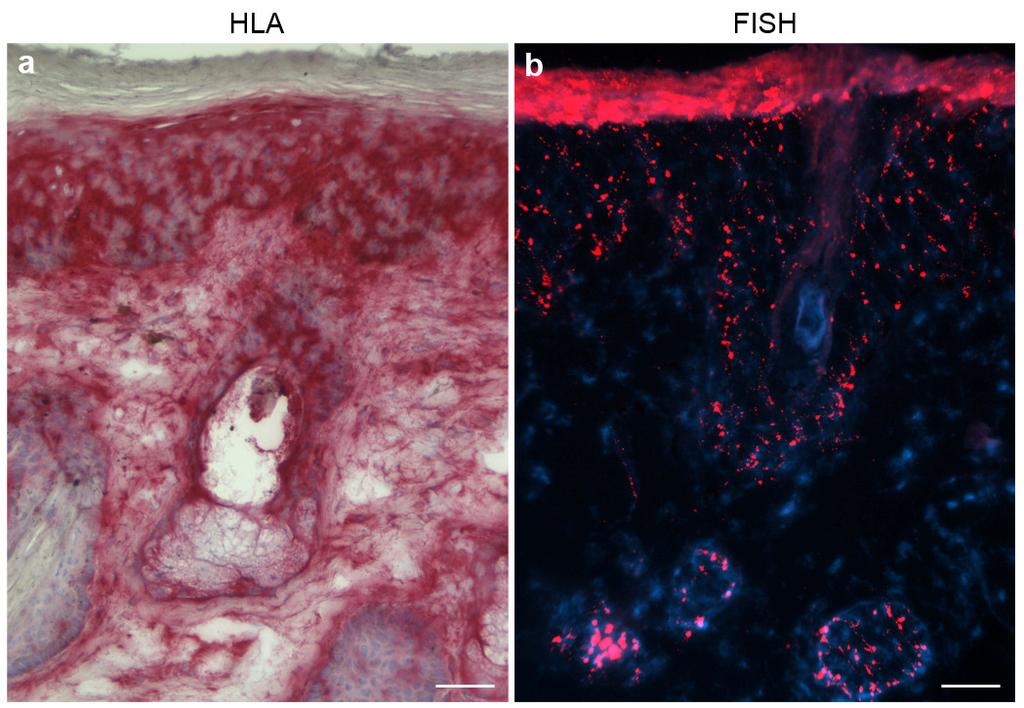Supplementary Figure S2. Characterization of hair follicles in grafts with TSC2-null cells from an angiofibroma.