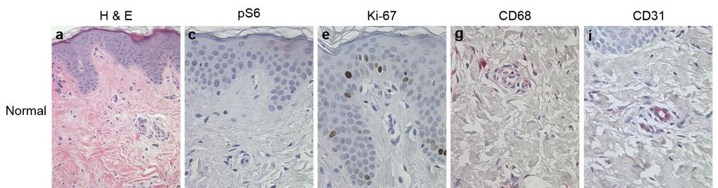 Supplementary Figure S3. Histological and immunohistological differences between TSC fibrous plaques and normal-appearing skin. (a) H & E stained section of TSC normal skin.