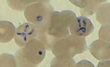 6 Babesia spp. agents of human babesiosis: B. microti: U.S. B. divergens: Europe infects red blood cells transmitted by Ixodes ticks Infection often silent or