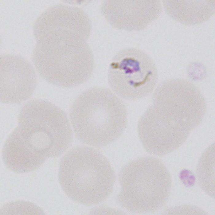 P malariae tends to infect older red blood cells and therefore in a lower parasitemia than P. falciparum.