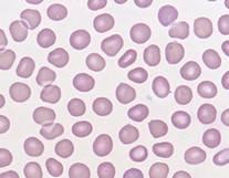, Transfusion 2010;50:1019-1027 studies limited to apheresis plasma and platelets