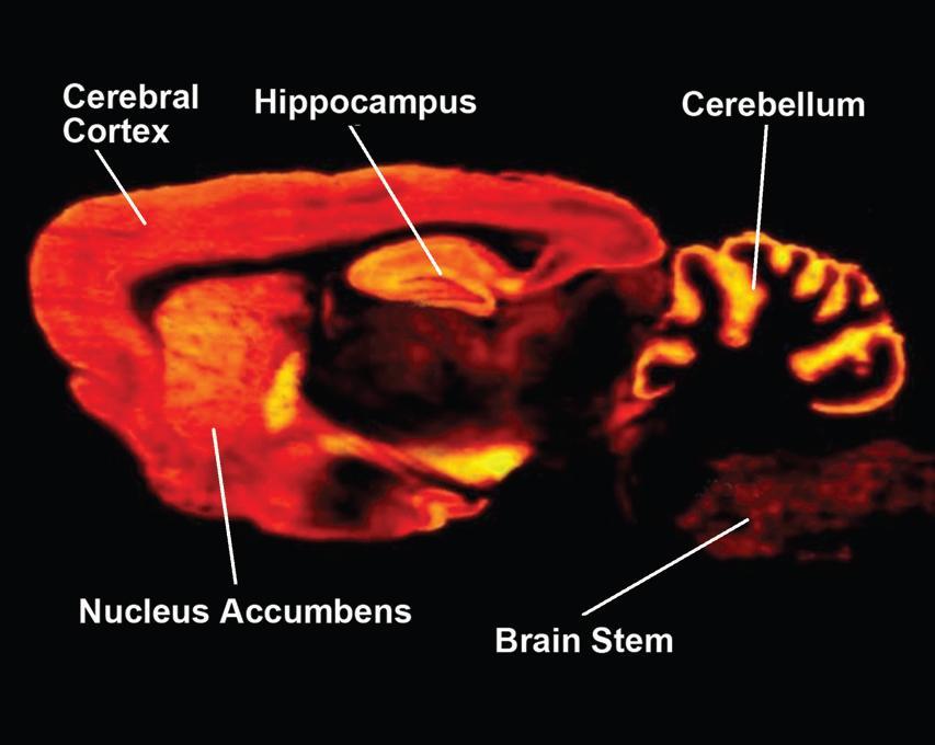 Marijuana, Memory, and the Hippocampus The hippocampus is the part of the brain that forms memories.