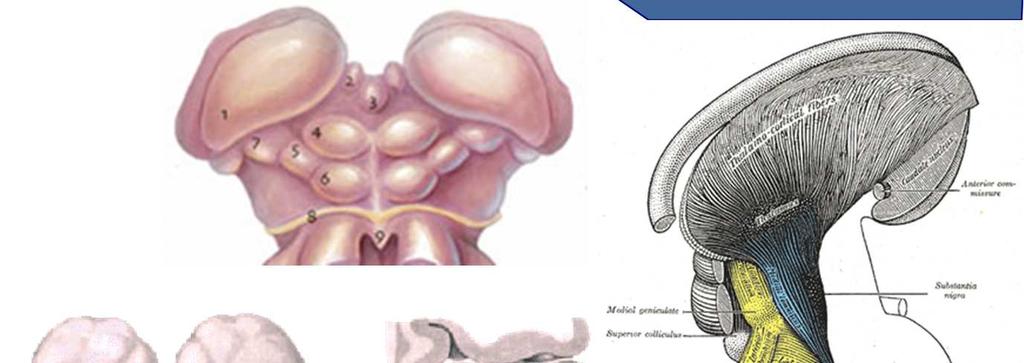 Midbrain Tectum, quadrigeminal plate superior colliculi inferior