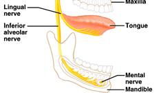 maxillary division i i sensory from upper teeth, upper gum, upper lip, palate, and skin of face mandibular