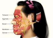 Cranial Nerve VII Facial (VII) both sensory and motor sensory from taste
