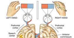 primary motor or primary sensory areas widespread throughout the cerebral