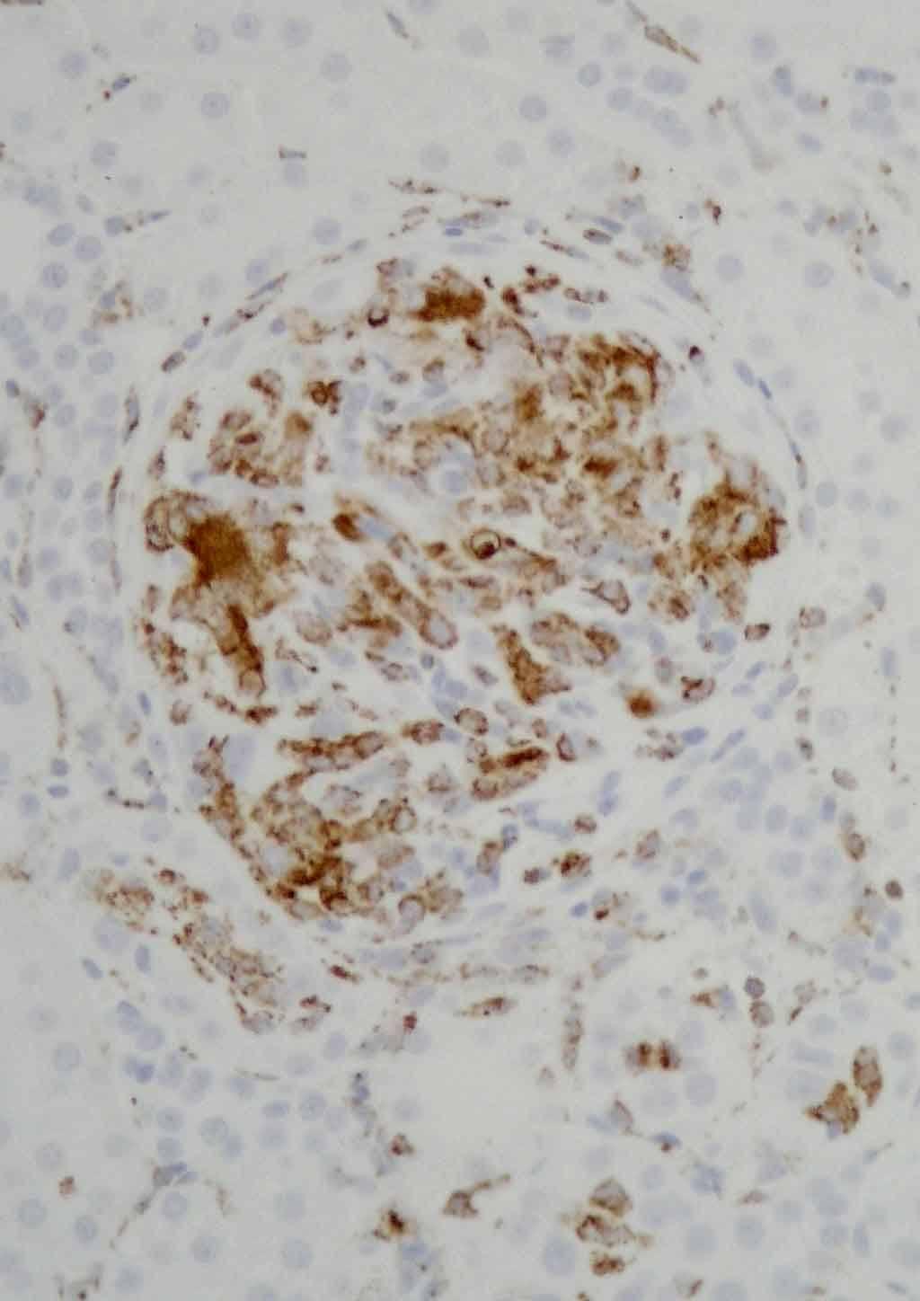 ED1+ cells/ glomerular cross section 40