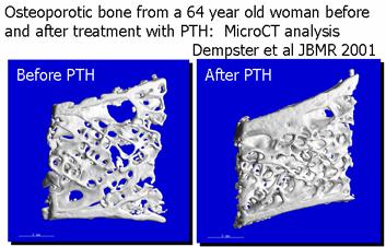 What are the Future Opportunities for Bone Research? Diagnostics/Imaging DXA is an imaging test that measures bone mineral density (BMD).