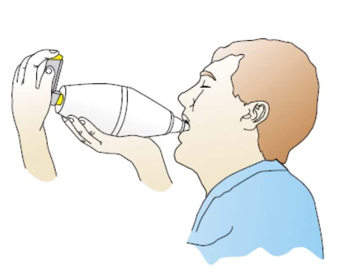 Knowledge of how to use a Spacer device with reliever medication Administration of reliever medication using a spacer 1. Shake the puffer 2. Insert puffer into the spacer 3.
