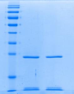 Lane 1: Molecular weight marker; Lane 2: Recombinant Biogenomics Trypsin; Lane 3: Reference standard.