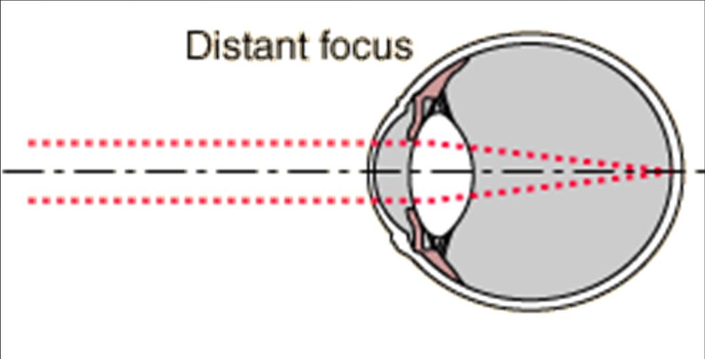 The Lens Lens: Transparent structure behind the pupil