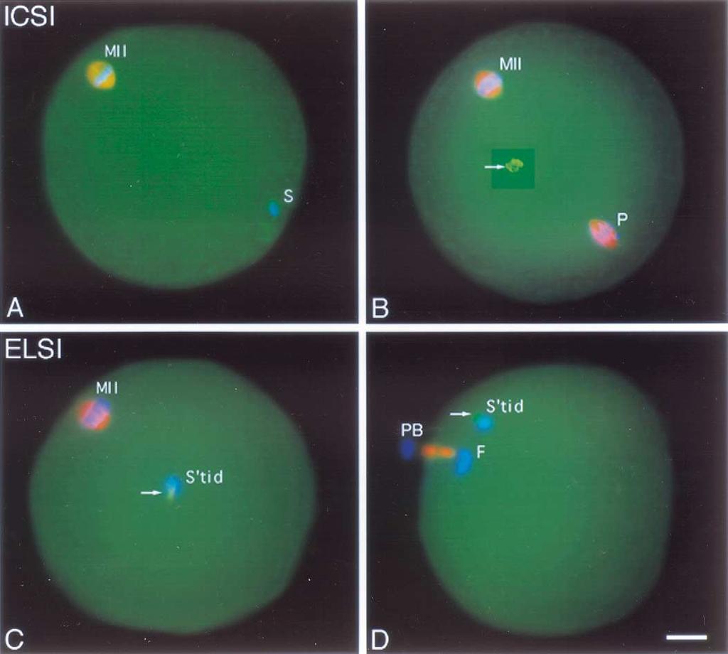 FIGURE 3 Microtubule and chromatin configurations of rhesus oocytes fixed 24 hours after TESA-ICSI (A, B) or ELSI (C, D).