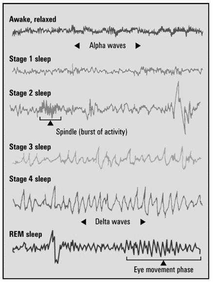 Peak period: Evening to Morning shift with age Jet lag: bright light helps to reset biological clock - Sleep Periodic, natural, reversible loss of consciousness - Stages