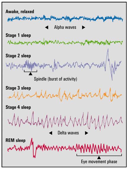Brain Waves and Sleep Stages Alpha Waves slow waves of a relaxed, awake brain
