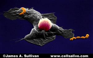 Ch. 22 The Lymphatic System and Immunity Above: macrophage (gray), T lymphocyte (pink), and bacteria (orange) The lymphatic system General functions: It acts with