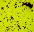 The demonstrated that adhesive bacteria showed a