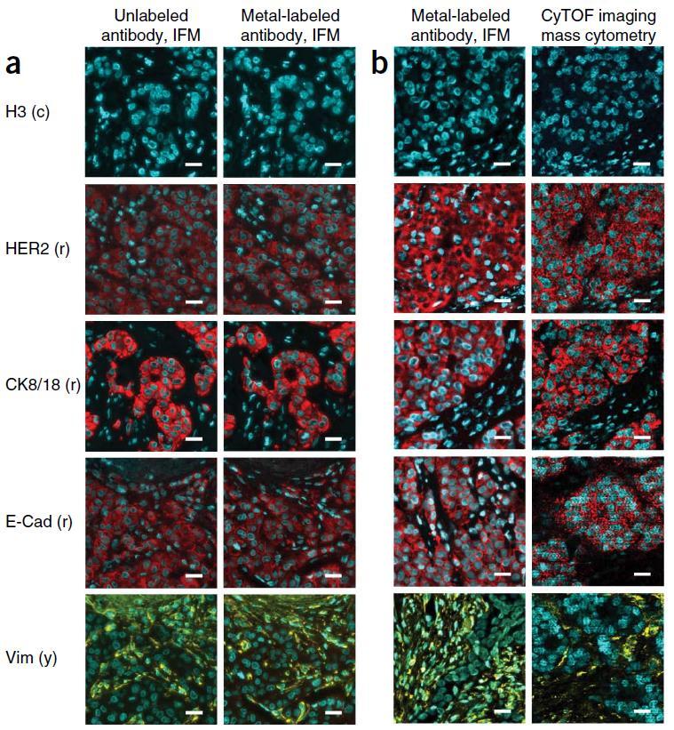Imaging mass cytometry (IMC) Paper 2 Validation of the approach using IHC: Comparison of metal-labeled and unlabeled antibodies in IFM using formalin-fixed paraffin-embedded breast cancer samples (a)