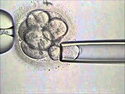 1. PGD/PGS/PND PGS identifies chromosomally normal embryos ("euploid" embryos) for transfer to the uterus in the