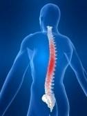 Chiropractic Treatment for Scoliosis, Upper Back Pain and Poor Posture DESCRIPTION OF CONDITION: Scoliosis/ upper back pain / poor posture causing neck stiffness, constant back pain and tension
