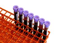 "Blood tests will increase the chance of detecting a hidden problem that could prove to be life threatening.
