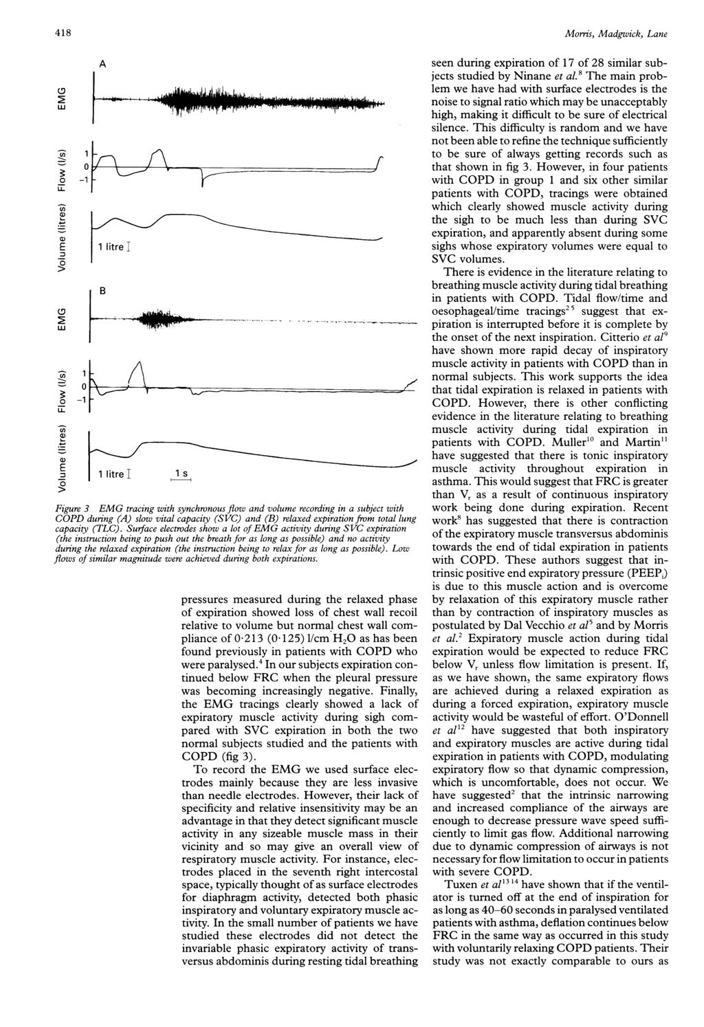 418 (3 LU A I S E 1 litrei g B (3~~~~~~~~~~7 cn -1 E 1 litrei s Figure 3 EMG tracing with synchronous flow and volume recording in a subject with COPD during (A) slow vital capacity (SVC) and (B)