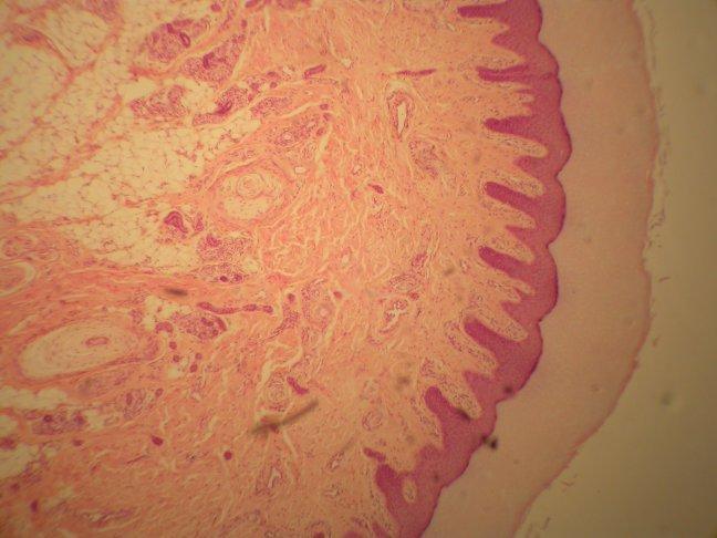 HYPODERMIS WITH ADIPOSE