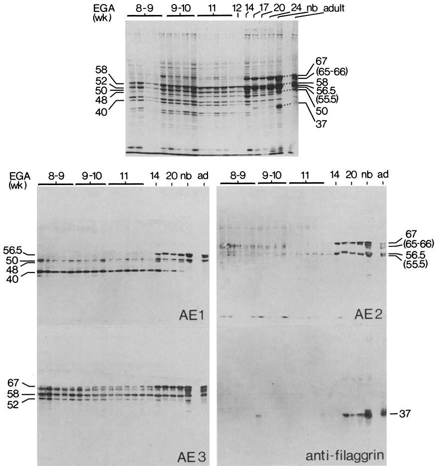 The position of various keratins (40 to 67 kd) and filaggrin (37 kd) is shown on the stained gel (top) and as appropriate on the immunoblots. AE1 reacts with the 40-, 50-, and 56.