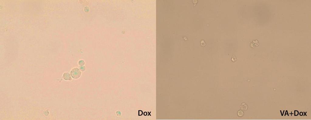 4.12. Senescencijom povezano β-galaktozidazno bojenje K562 ćelija U cilju potvrđivanja senescentnog fenotipa K562 ćelija tretiranih subapoptotičnom koncetracjiom Dox (0.