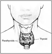 Hyperparathyroidism Primary hyperparathyroidism is a disorder of the parathyroid glands, also called parathyroids.