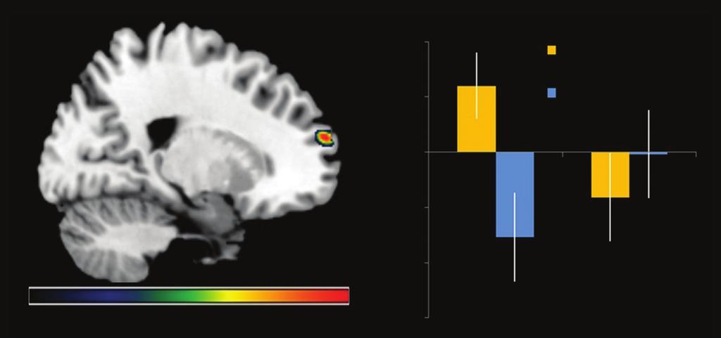Reported activations were thresholded at p < 0.005, with an extent threshold of 43 contiguous voxels, corresponding to a false-positive discovery rate of less than 5% across the whole brain. 1.