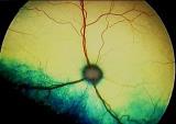 the brain Retinal