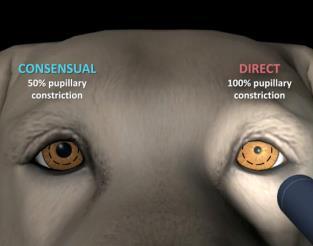 light perception Pupillary