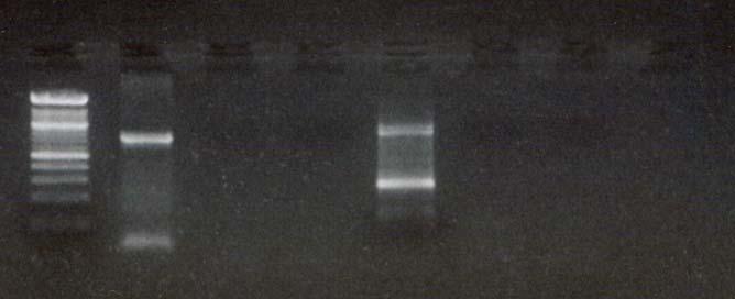 RT-PCR test for FIP1L1-PDGFRα