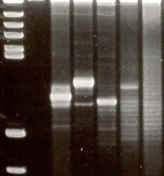 tests: FISH t(11;18)(q21;q21) RT-PCR