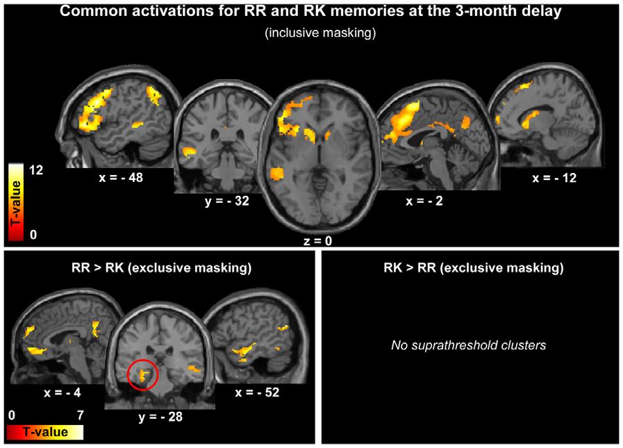 Figure 3. Common and specific activations for RR and RK memories, 3 months after encoding. Common activations (top) are displayed at p,0.05 (FWE corrected) and specific activations (bottom) at p,0.