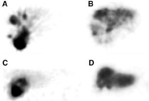 coregistration imaging to provide contrast.