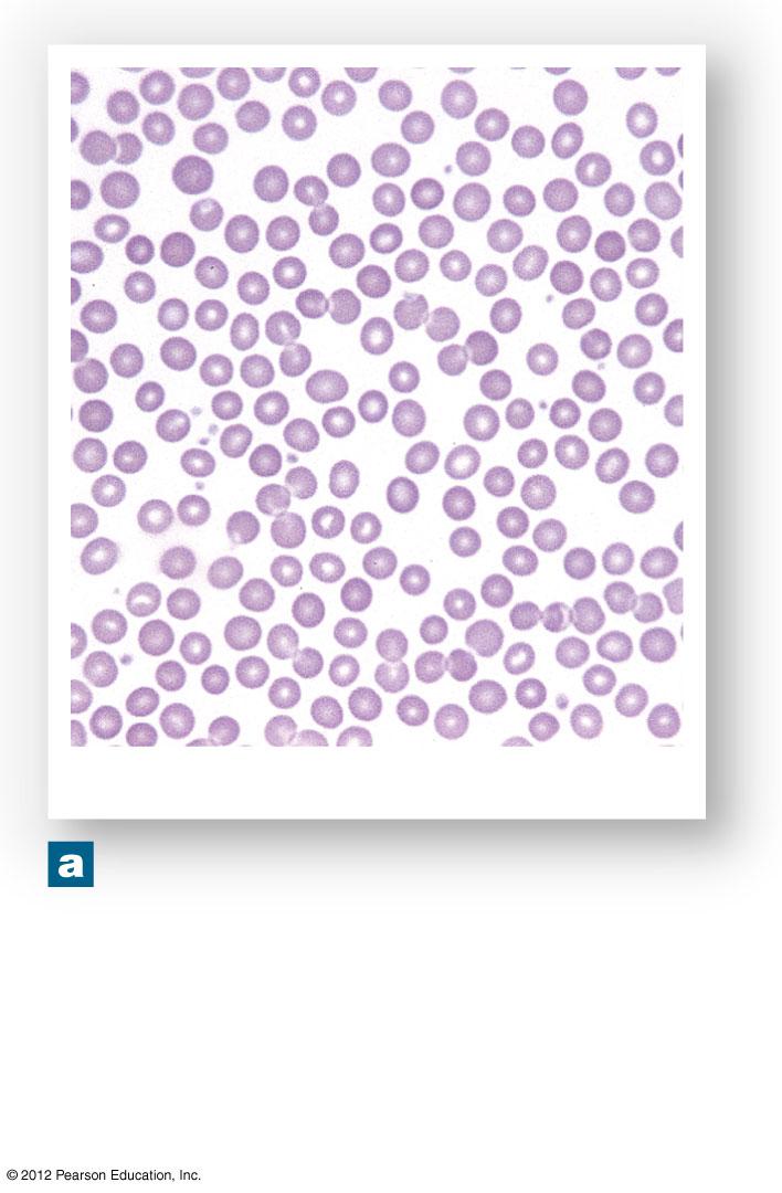 Figure 19-2a The Anatomy of Red Blood Cells Blood smear LM 477 When viewed in a standard blood