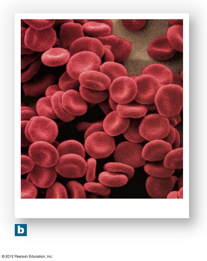 Figure 19-2b The Anatomy of Red Blood Cells Red