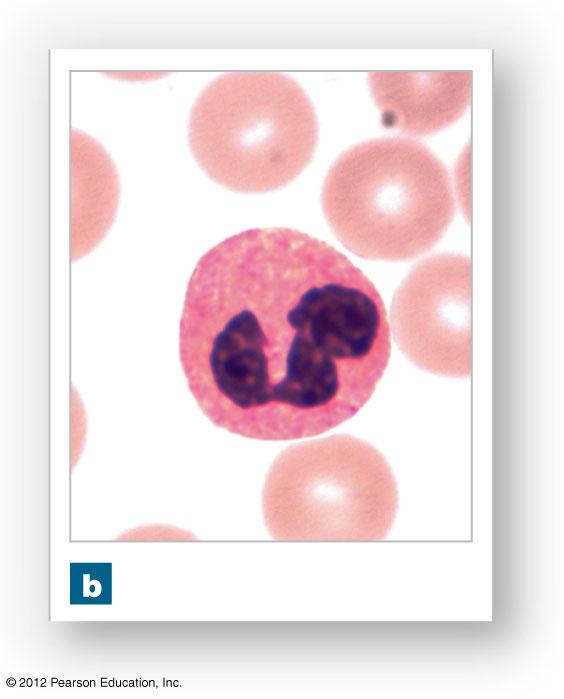 Figure 19-10b White Blood