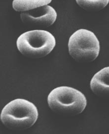 Red Blood Cells (erythrocytes) Structure of a Red Blood Cell Red blood cells have