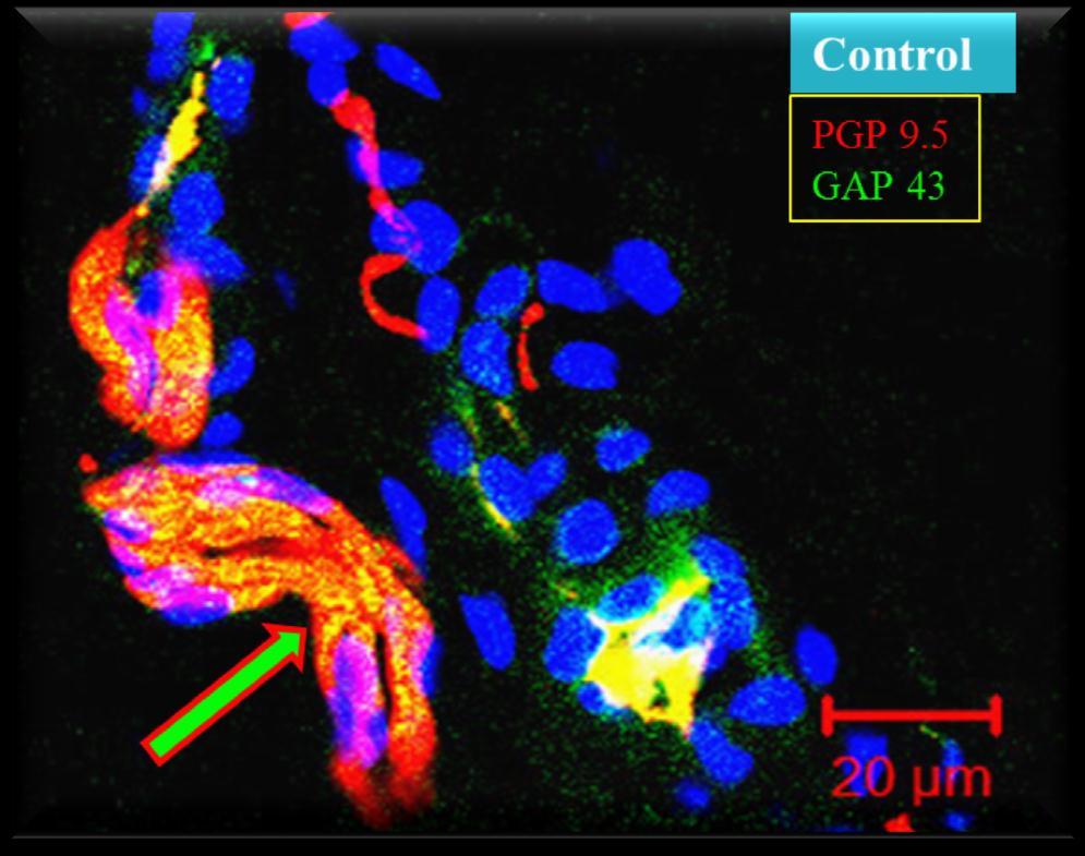 GAP43 +ve regenerating fibers in