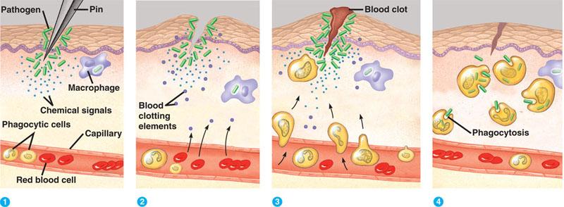 The Inflammatory Response Histamine Releases (basophils and mast cells) Allows for dilation and increased