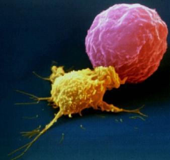 Natural Killer Cells Recognize damaged or diseased cells
