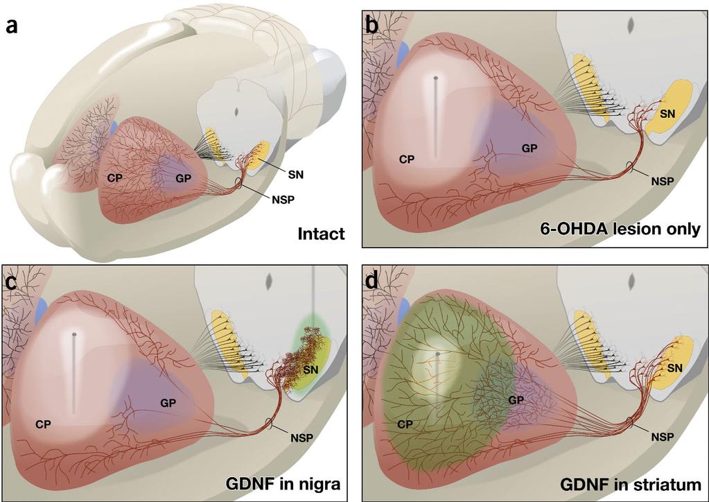 Figure 1 Protective effects of GDNF in the intrastriatal 6-OHDA model.